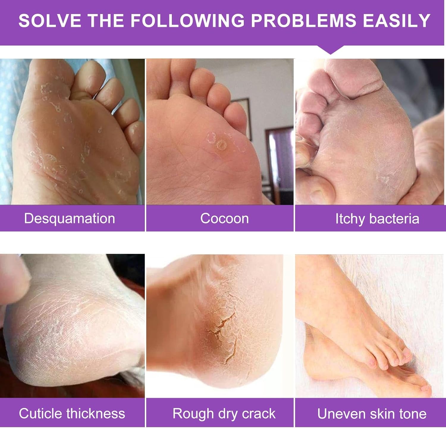 ALIVER Exfoliating Foot Mask – Lavender – 5 Pack | Peels Dead Skin for Baby-Soft Feet ALIVER Exfoliating Foot Mask – Lavender – 5 Pack | Peels Dead Skin for Baby-Soft Feet