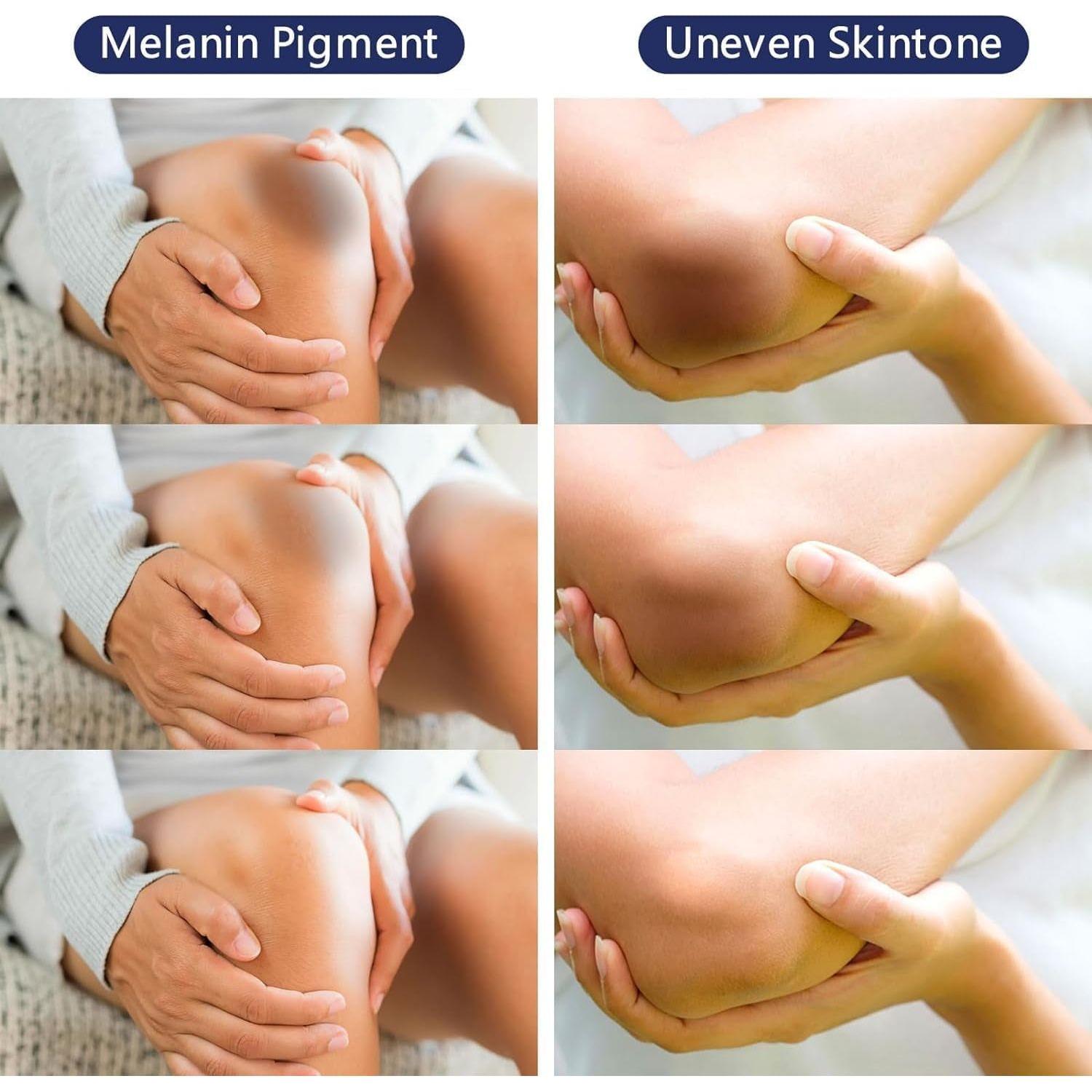 Gukei Bleaching Cream | Skin Lightening & Whitening Cream for Intimate Areas - 1.06 fl oz (30ml) Gukei Bleaching Cream | Skin Lightening & Whitening Cream for Intimate Areas - 1.06 fl oz (30ml)