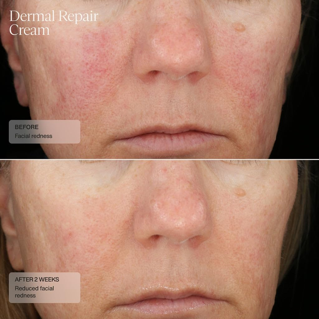 SENTÉ Dermal Repair Facial Cream – 50ml | Calms Redness, Repairs Skin Barrier & Hydrates Sensitive Skin SENTÉ Dermal Repair Facial Cream – 50ml | Calms Redness, Repairs Skin Barrier & Hydrates Sensitive Skin