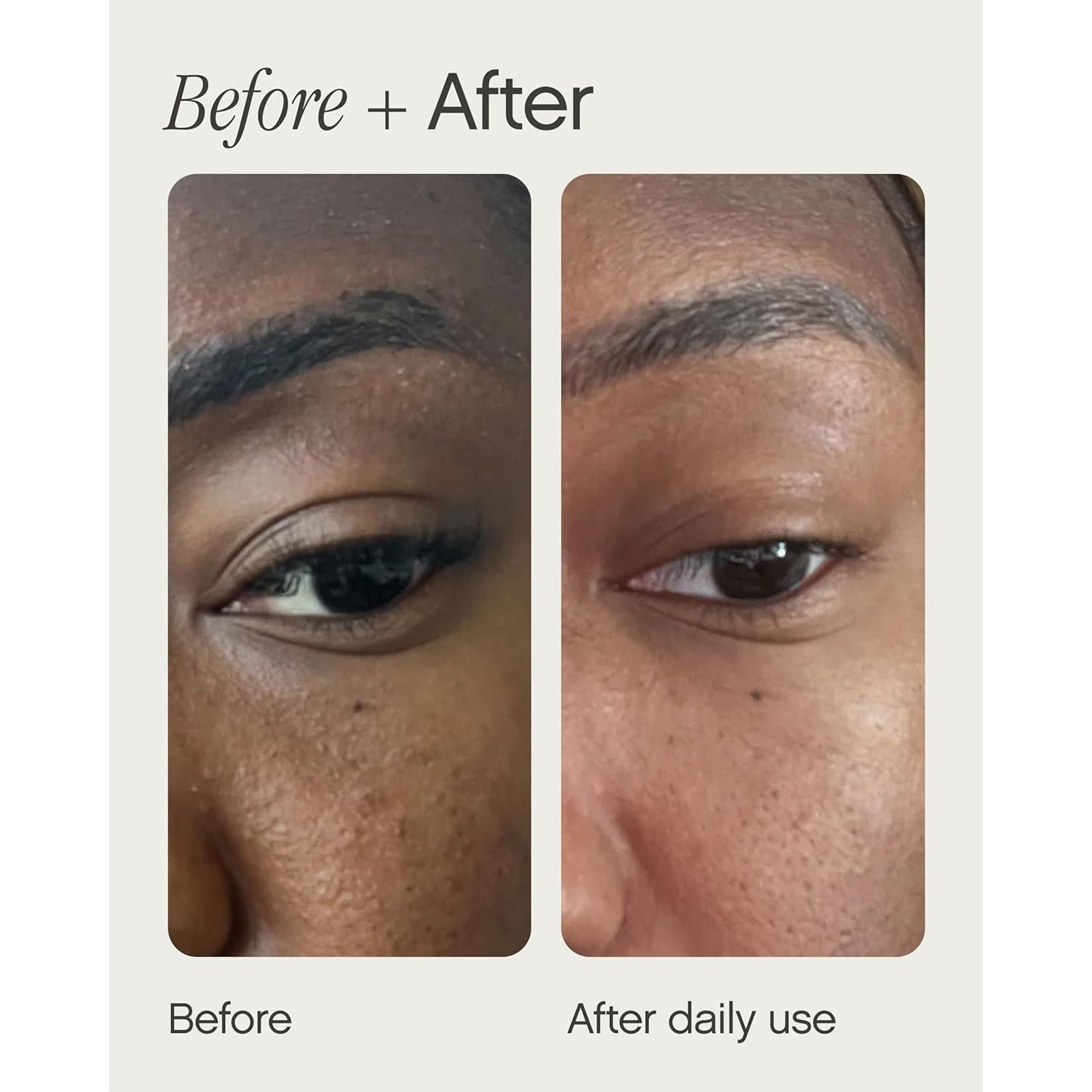 Topicals Sealed Active Scar Primer – 28ml | Instantly Smooths & Improves Scar Appearance Topicals Sealed Active Scar Primer – 28ml | Instantly Smooths & Improves Scar Appearance