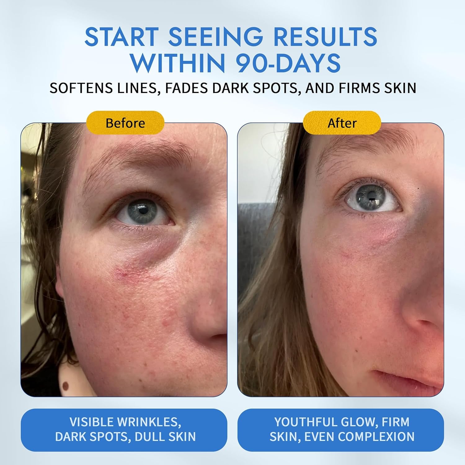 MAELOVE Moonlight Retinal Super Serum – 30ml | 10x Potent Retinol Alternative for Anti-Aging & Acne-Prone Skin MAELOVE Moonlight Retinal Super Serum – 30ml | 10x Potent Retinol Alternative for Anti-Aging & Acne-Prone Skin