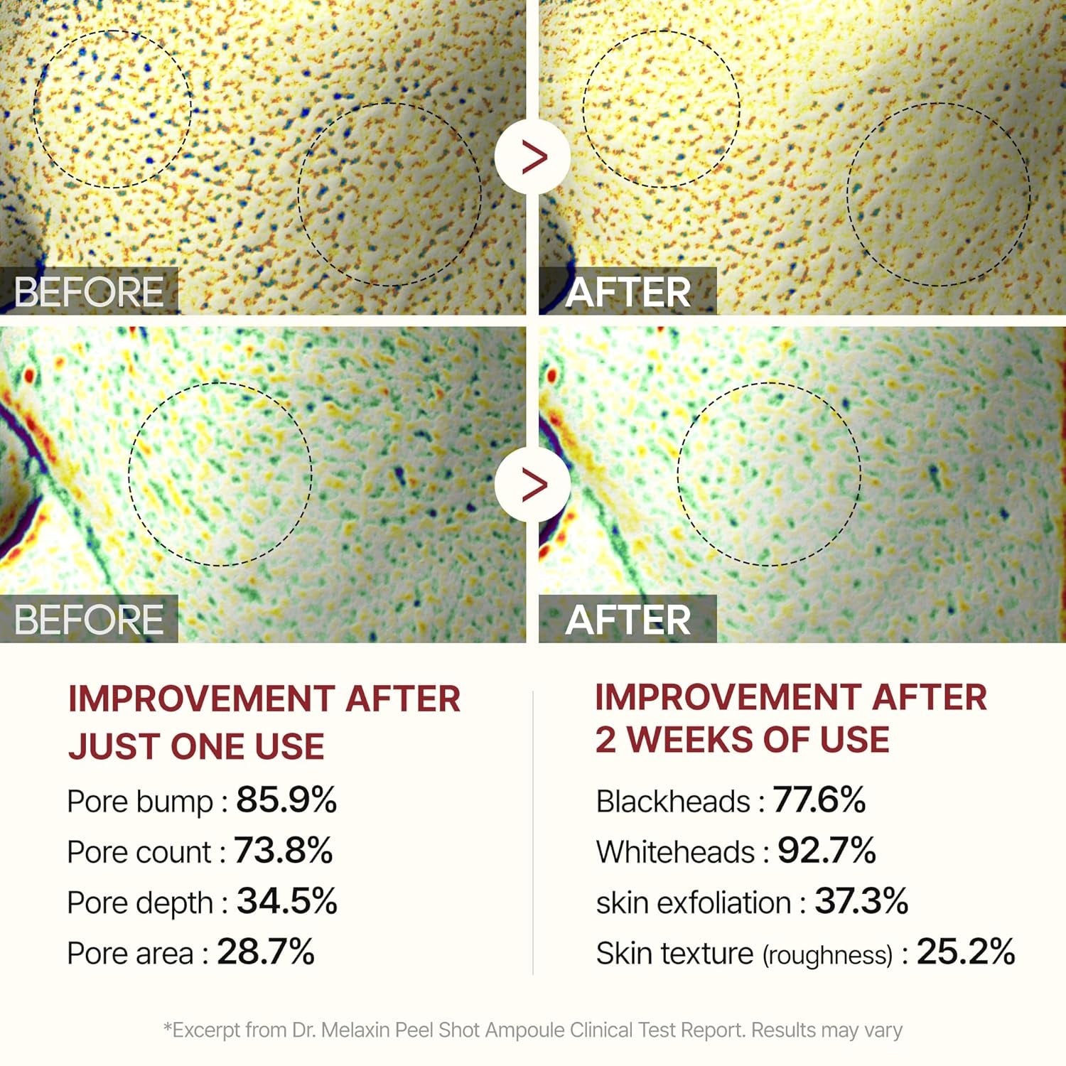Dr.Melaxin Peel Shot Exfoliant Rice Ampoule – 80ml | Radiance-Boosting, Multi-Acid Exfoliating Ampoule with Deep Hydration Dr.Melaxin Peel Shot Exfoliant Rice Ampoule – 80ml | Radiance-Boosting, Multi-Acid Exfoliating Ampoule with Deep Hydration