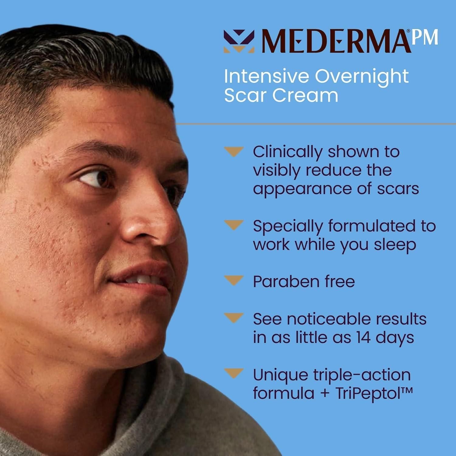 Mederma Intensive Overnight Scar Cream – 30ml | Clinically Proven Scar Treatment Mederma Intensive Overnight Scar Cream - 30ml - Glam Global UKMederma