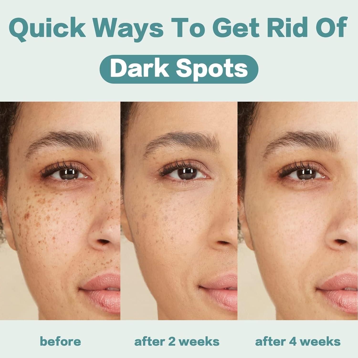 CITYGOO Dark Spot Corrector Cream - 50ml | Natural Ingredients for Even Skin Tone CITYGOO Dark Spot Corrector Cream - Natural Ingredient - 50ml - Glam Global UKCITYGOO
