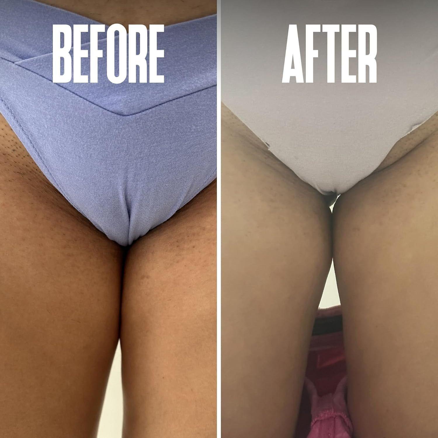 Divine Derriere Ingrown Hair Pads – 50 Pads | Exfoliating Razor Bump & Ingrown Hair Treatment Divine Derriere Ingrown Hair Pads – 50 Pads | Exfoliating Razor Bump & Ingrown Hair Treatment