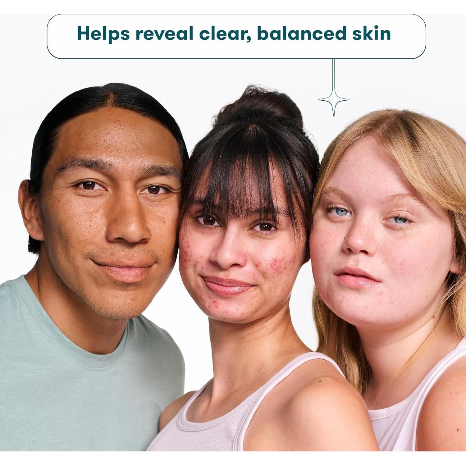 ProactivMD Balancing Toner with Witch Hazel – 180ml | Alcohol-Free Toner for Pore Tightening & pH Balance Proactiv MD Balancing Toner with Witch Hazel - 180ml - Glam Global UKProactiv