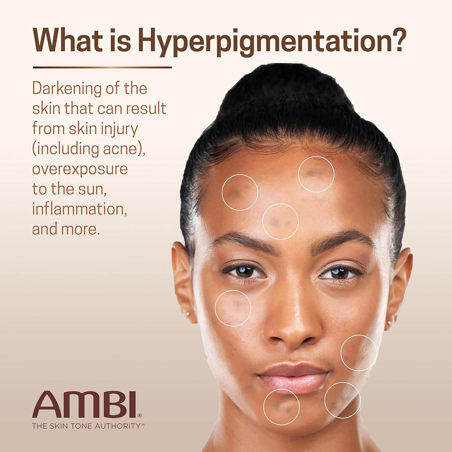 Ambi Even & Clear Advanced Fade Cream – 30ml | Hydroquinone-Free Dark Spot Corrector with Niacinamide, PHA & Licorice Root Ambi Even & Clear Advanced Fade Cream Hydroquinone - Free - 30ml - Glam Global UKAmbi