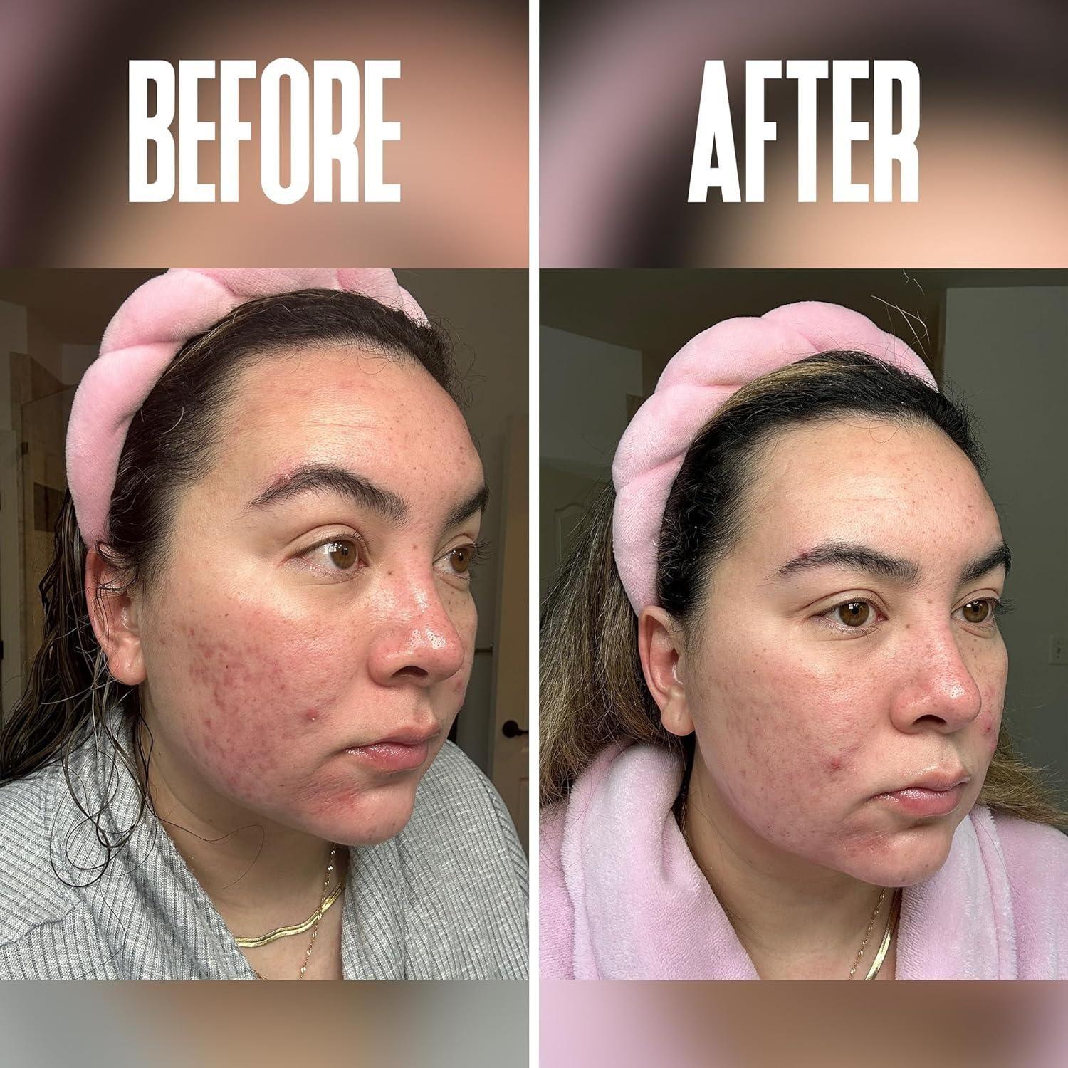 Divine Derriere Spa Strength Exfoliating Pads with Glycolic Acid 20% AHA - 50ml Divine Derriere Spa Strength Exfoliating Pads with Glycolic Acid 20% AHA - 50ml - Glam Global UKDivine Derriere