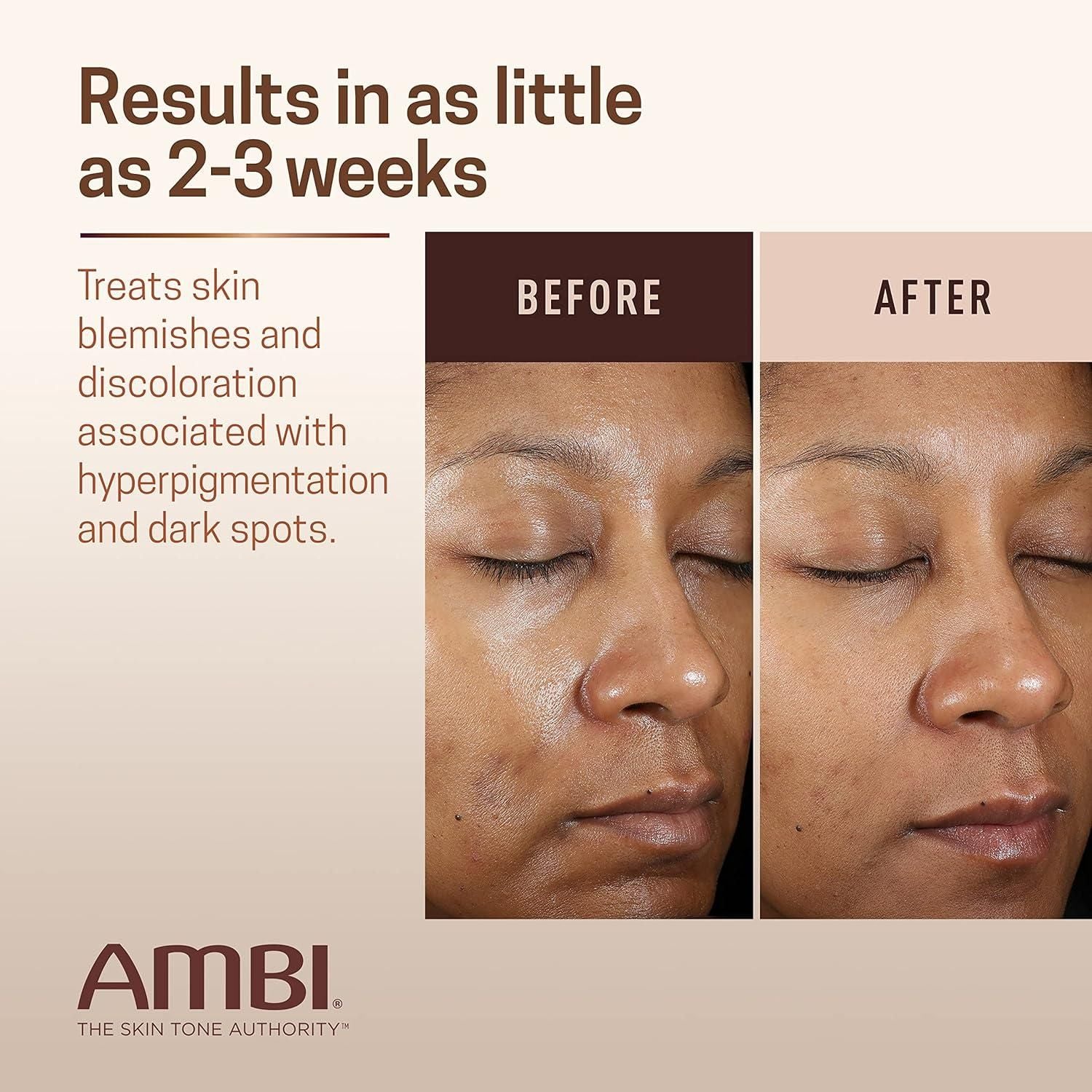 Ambi Even & Clear Advanced Fade Cream – 30ml | Hydroquinone-Free Dark Spot Corrector with Niacinamide, PHA & Licorice Root Ambi Even & Clear Advanced Fade Cream Hydroquinone - Free - 30ml - Glam Global UKAmbi