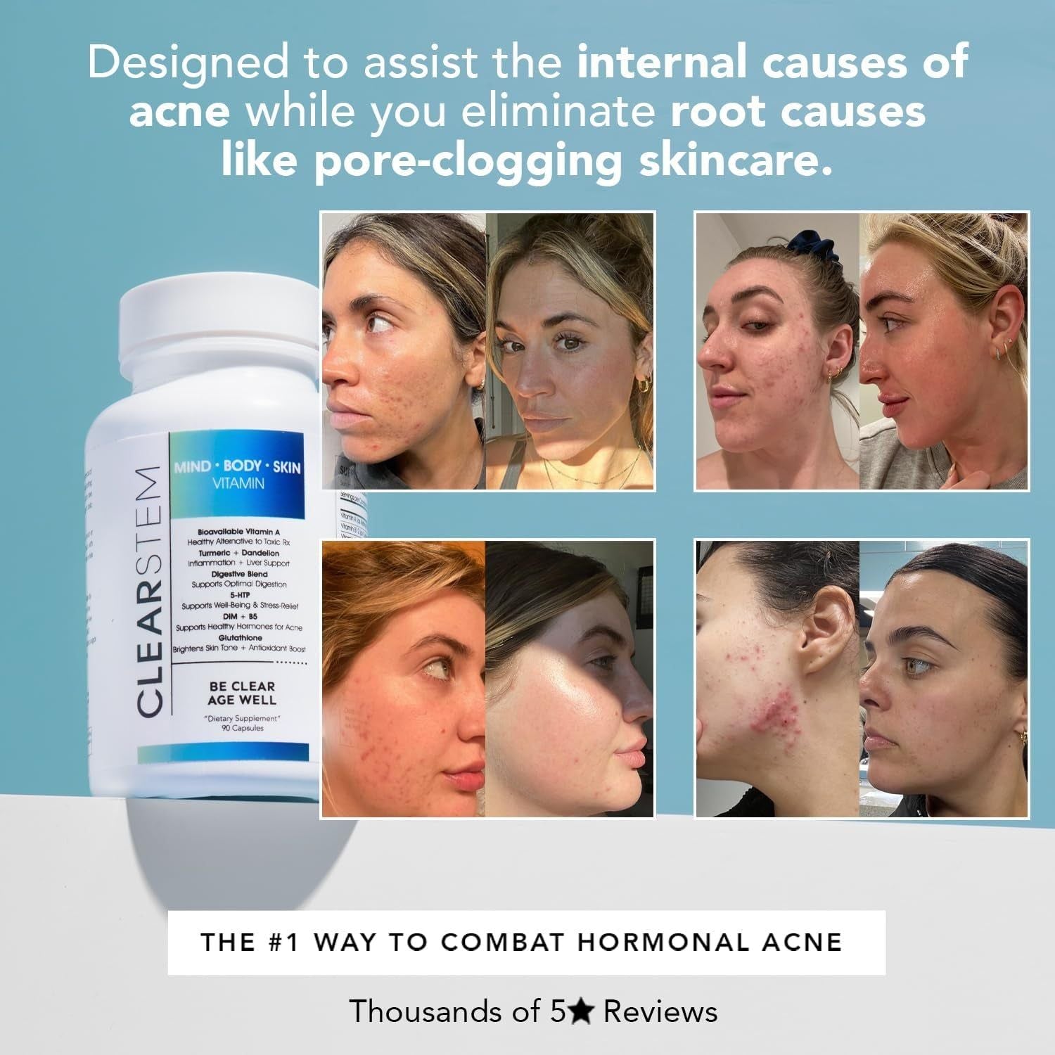 CLEARSTEM MIND·BODY·SKIN® Vitamin (with 5-HTP) – 90 Capsules | Hormonal Acne Relief, Mood Support & Clear Skin from Within CLEARSTEM MIND·BODY·SKIN® Vitamin (with 5-HTP) – 90 Capsules | Hormonal Acne Relief, Mood Support & Clear Skin from Within