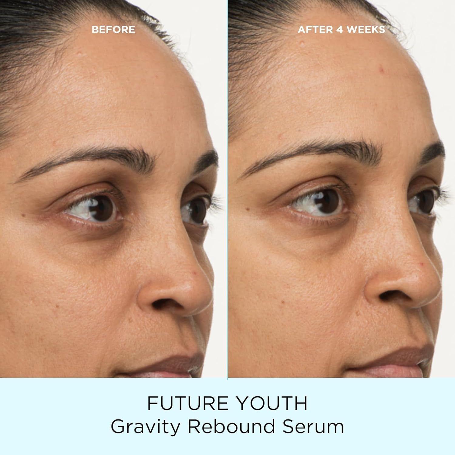 Pacifica Future Youth Gravity Rebound Serum – 29ml | Firming & Anti-Aging Peptide Serum Pacifica Future Youth Gravity Rebound Serum – 29ml | Firming & Anti-Aging Peptide Serum