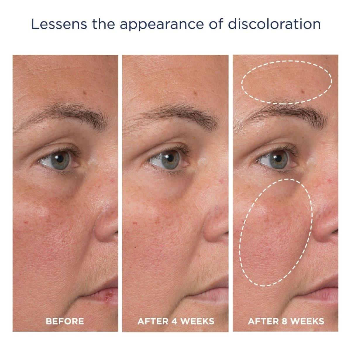 M-61 Advanced Essentials Four Step Skincare System | Clinically Proven Glow-Boosting Regimen M - 61 Advanced Essentials Four Step Skincare System - Glam Global UKM - 61