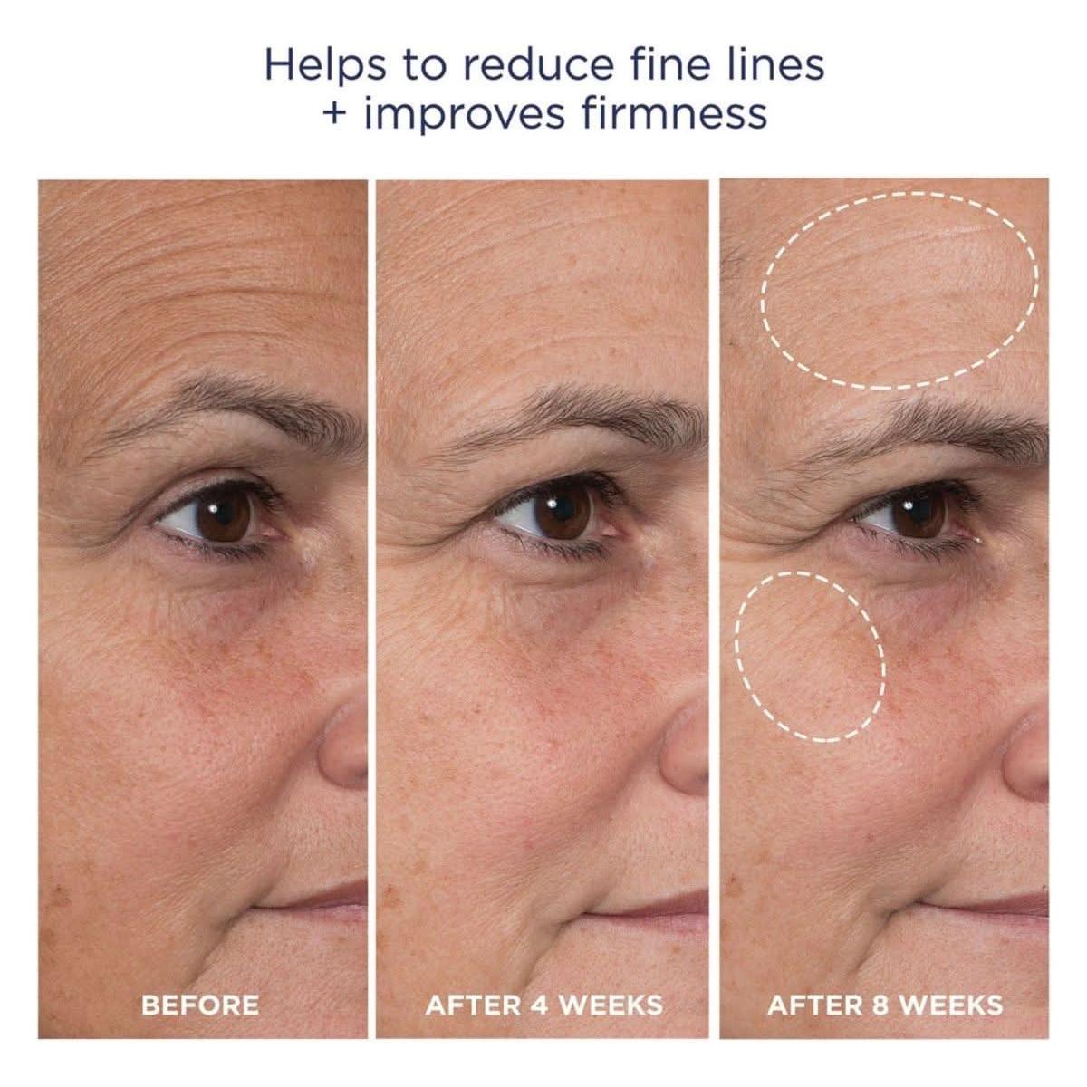 M-61 Advanced Essentials Four Step Skincare System | Clinically Proven Glow-Boosting Regimen M - 61 Advanced Essentials Four Step Skincare System - Glam Global UKM - 61