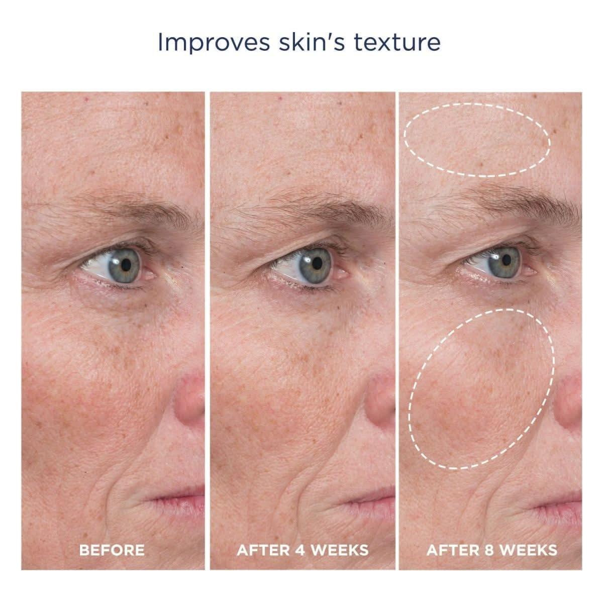 M-61 Advanced Essentials Four Step Skincare System | Clinically Proven Glow-Boosting Regimen M - 61 Advanced Essentials Four Step Skincare System - Glam Global UKM - 61