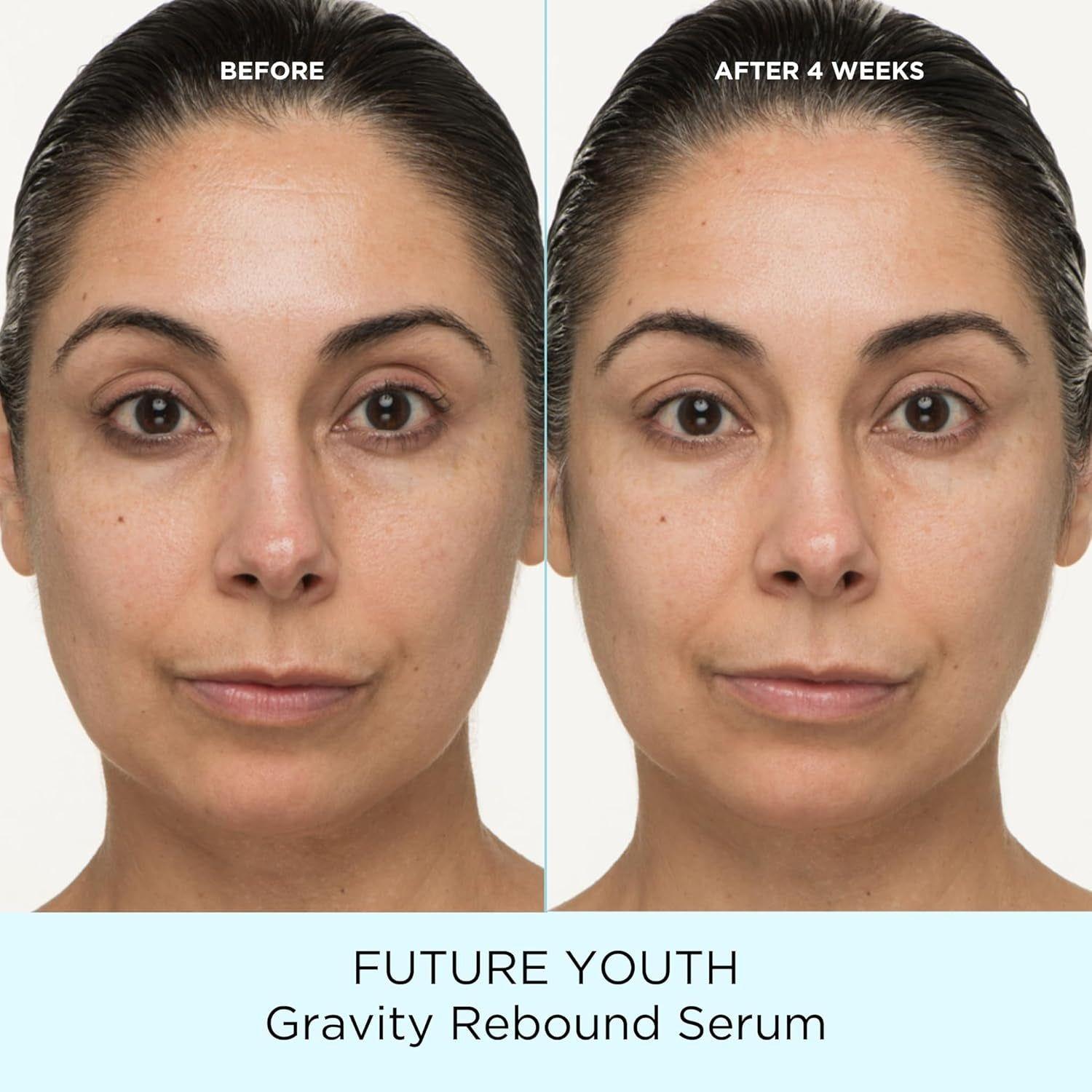 Pacifica Future Youth Gravity Rebound Serum – 29ml | Firming & Anti-Aging Peptide Serum Pacifica Future Youth Gravity Rebound Serum – 29ml | Firming & Anti-Aging Peptide Serum