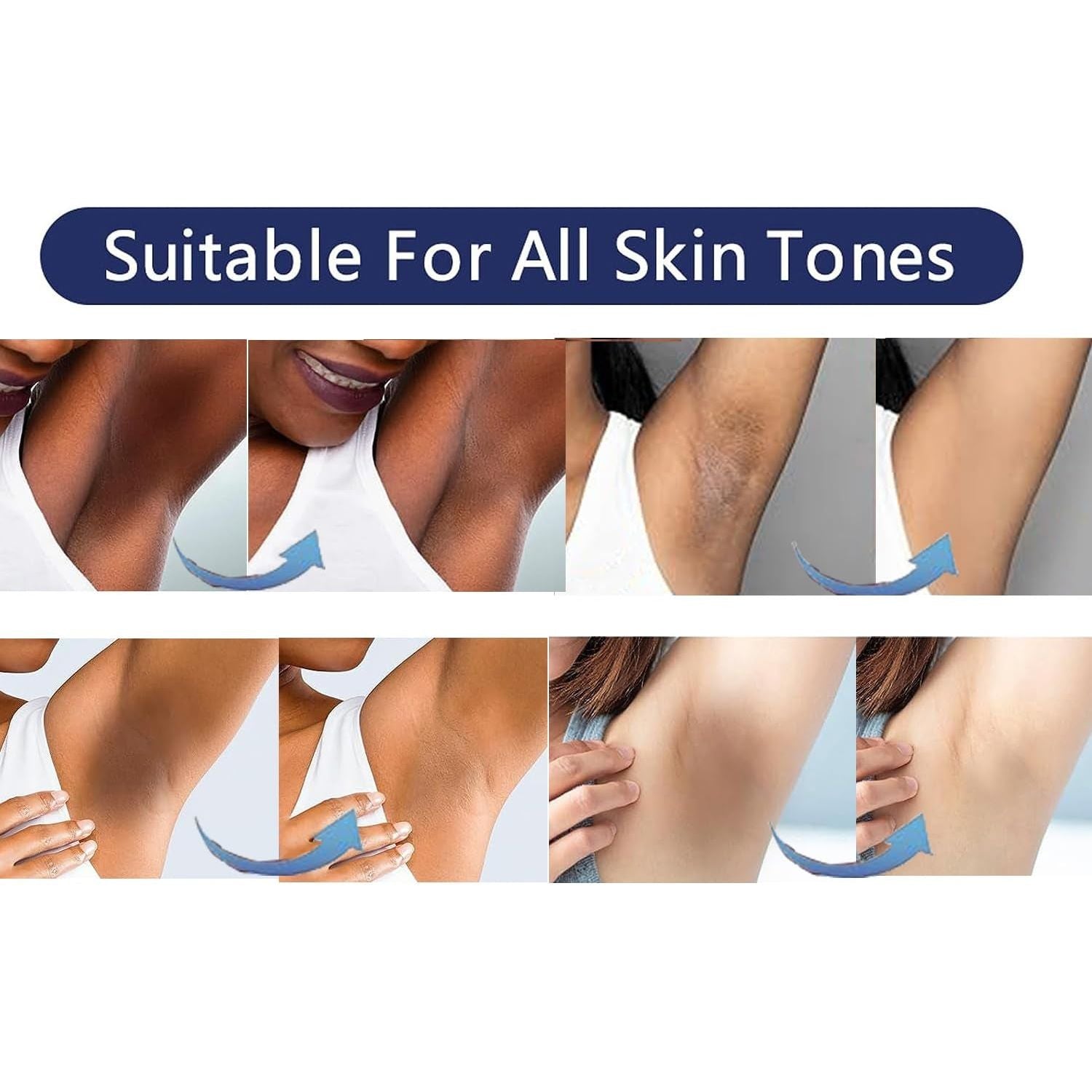 Gukei Bleaching Cream | Skin Lightening & Whitening Cream for Intimate Areas - 1.06 fl oz (30ml) Gukei Bleaching Cream | Skin Lightening & Whitening Cream for Intimate Areas - 1.06 fl oz (30ml)