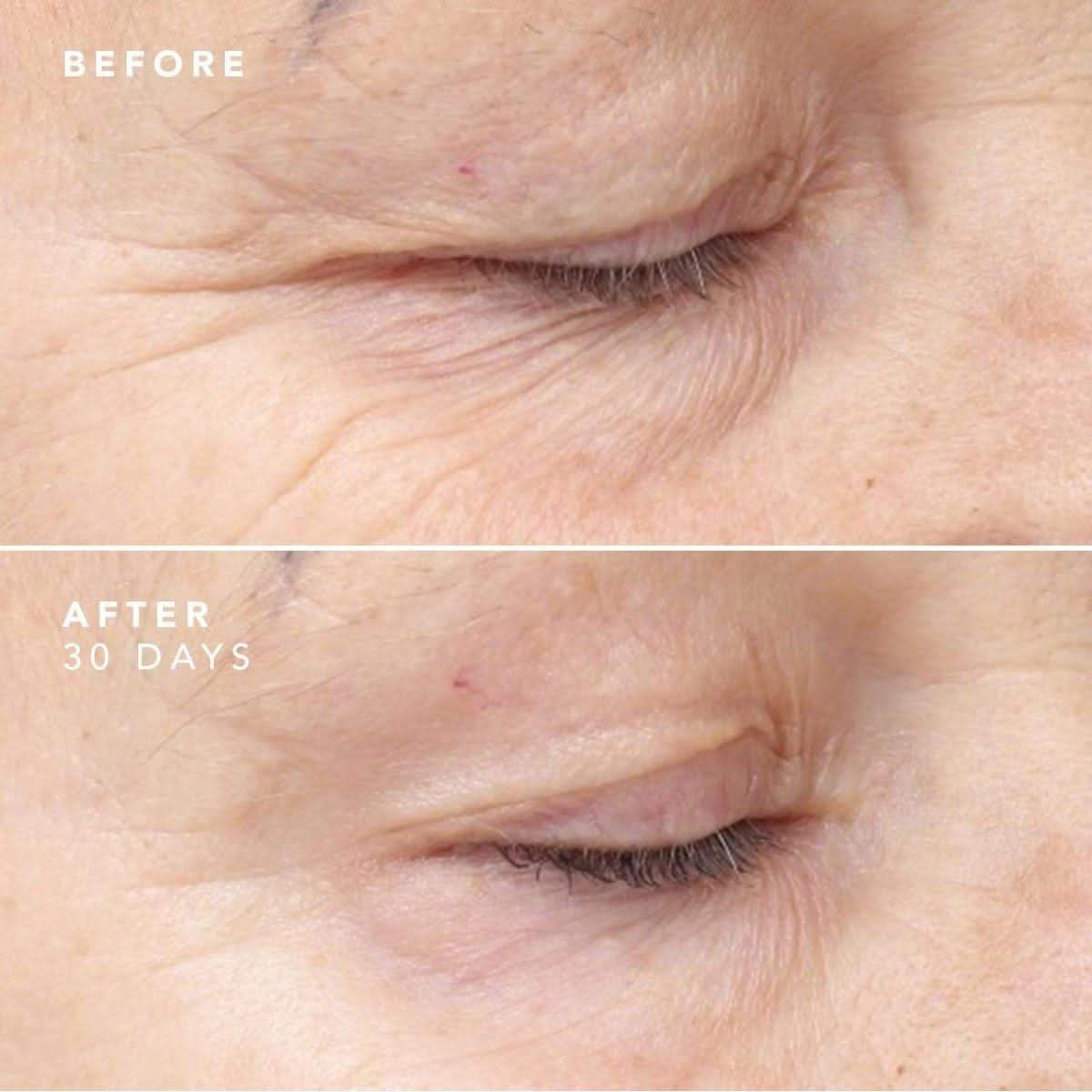 BIOEFFECT 30 Day Treatment – 3 x 5ml | Intensive Anti-Aging Skincare Boost BIOEFFECT 30 Day Treatment 3 x 5ml - Glam Global UKBIOEFFECT