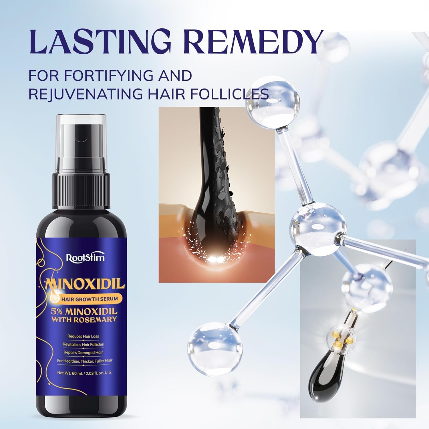 RootSim 5% Minoxidil Hair Growth Serum – 60ml | Extra Strength Regrowth Treatment for Men & Women with Rosemary 5% Minoxidil Hair Growth for Men and Women: Extra Strength Minoxidil Hair Loss Treatment Serum with Rosemary for Faster Stronger Thicker Hair Growth 60ML