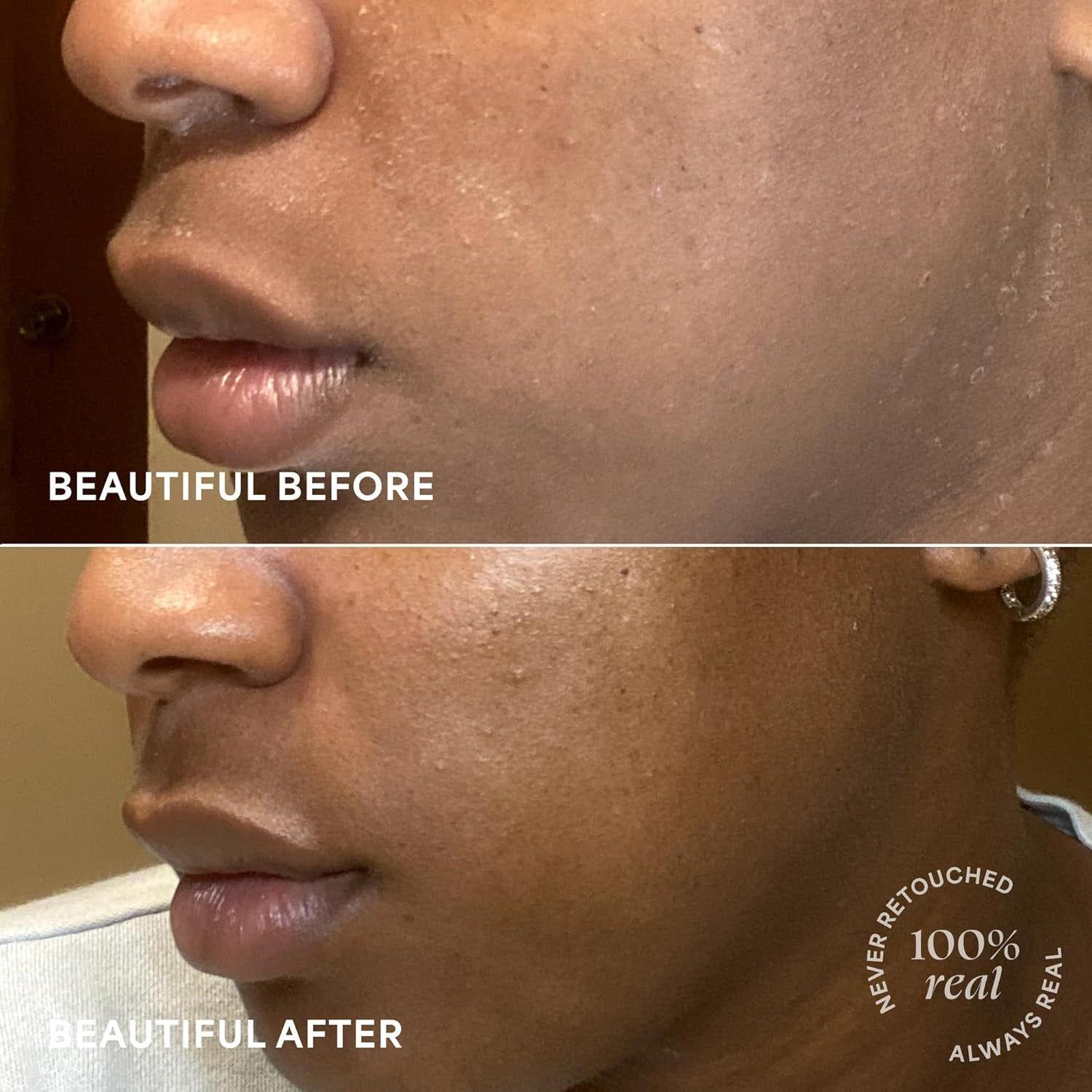 TULA SKINCARE 24-7 Moisture Intense Ultra Hydrating Day & Night Cream (Regular) – 43g | Deep Hydration & Skin Barrier Support TULA SKINCARE 24-7 Moisture Intense Ultra Hydrating Day & Night Cream (Regular) – 43g | Deep Hydration & Skin Barrier Support