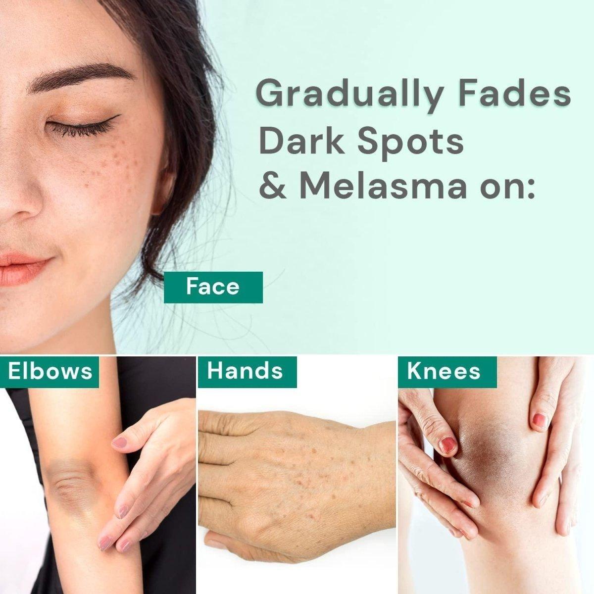 Ebanel Ultra Potent Facial Cream Dark Spot Remover – 44g | Targeted Treatment for Even Skin Tone & Radiance Ebanel Ultra Potent Facial Cream Dark Spot Remover - 44ml - Glam Global UKEbanel