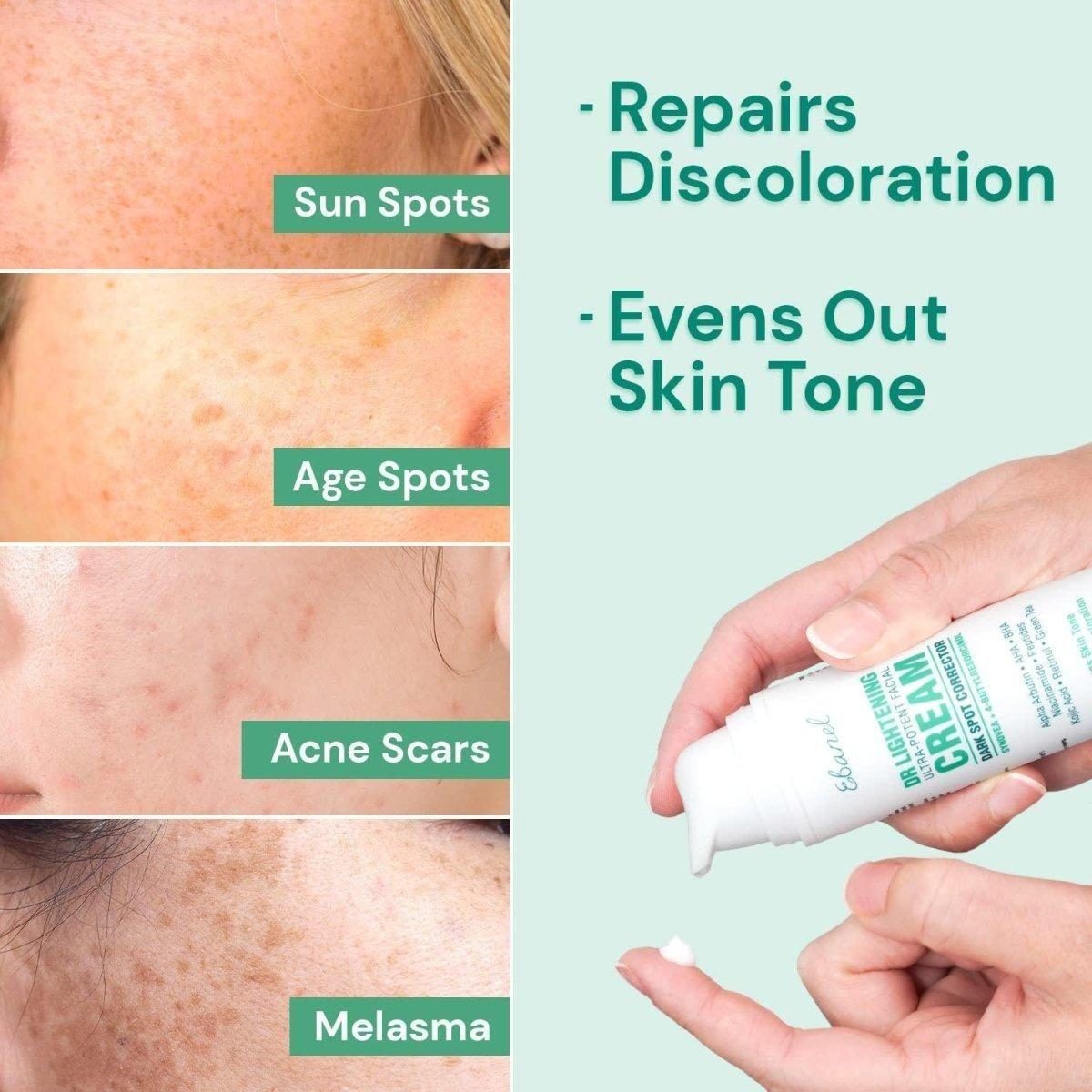 Ebanel Ultra Potent Facial Cream Dark Spot Remover – 44g | Targeted Treatment for Even Skin Tone & Radiance Ebanel Ultra Potent Facial Cream Dark Spot Remover - 44ml - Glam Global UKEbanel