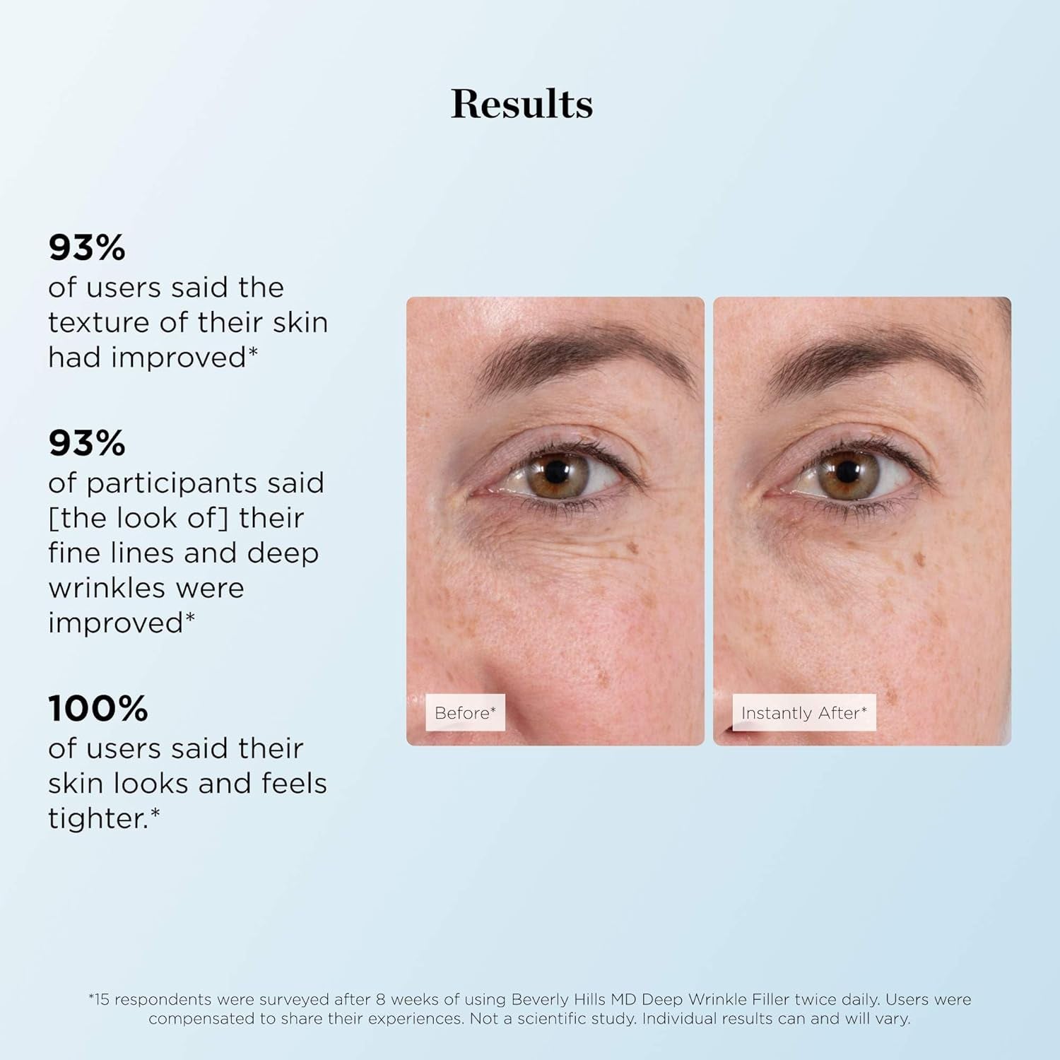 Beverly Hills MD Deep Wrinkle Filler – 4.7g | Instant Smoothing for Fine Lines & Deep Wrinkles Beverly Hills MD Deep Wrinkle Filler – 4.7g | Instant Smoothing for Fine Lines & Deep Wrinkles