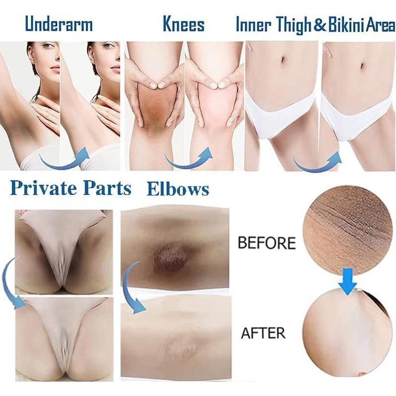 Gukei Bleaching Cream | Skin Lightening & Whitening Cream for Intimate Areas - 1.06 fl oz (30ml) Gukei Bleaching Cream | Skin Lightening & Whitening Cream for Intimate Areas - 1.06 fl oz (30ml)