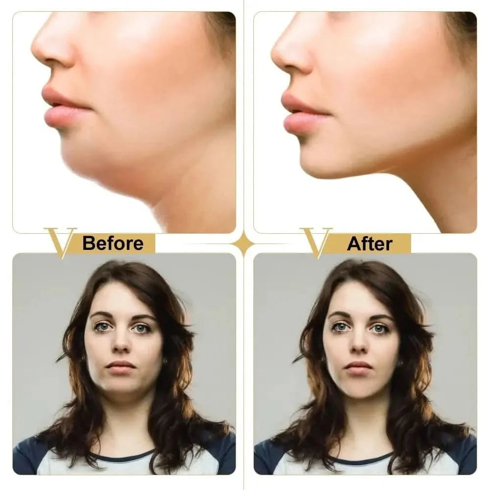 Face Lifting V Shape Slimming Mask | Define Jawline & Sculpt Facial Contours Face Lifting V Shape Slimming Mask - Glam Global UKGlam Global UK