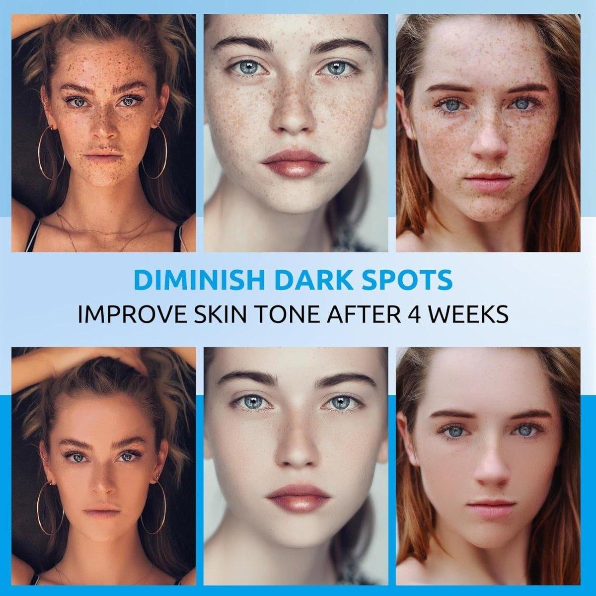 HANYWIL Dark Spot Corrector  Face and Body Cream – 60 ml | Professional Dark Spot Remover for Stubborn Pigmentation, Sun Spots, and Uneven Skin Tone | Hydrating, Fast-Acting Formula HANYWIL Dark Spot Corrector Face and Body Cream 2 fl oz - 60 ml - Glam Global UKHANYWIL