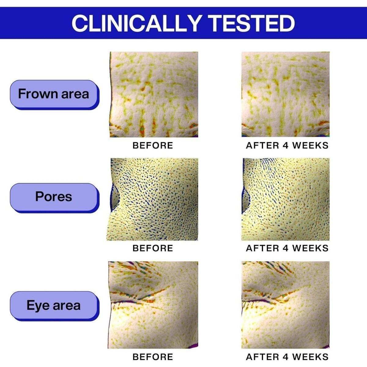 IOPE Retinol Super Bounce Serum  | Intensive Reactivating Korean Retinol for Daily Use IOPE Serum Super Bounce Serum - Intensive Reactivating Korean Retinoid - Glam Global UKIOPE