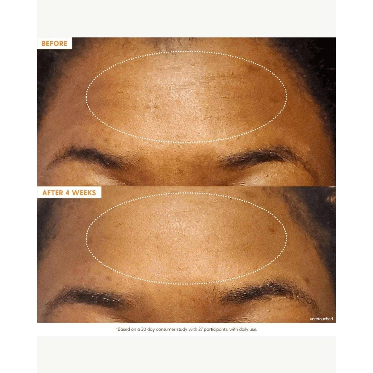 Kinship Brightwave 10% Vitamin C + Peptide Brightening Serum – 30ml | Brighten, Firm & Smooth Kinship Brightwave 10% Vitamin C + Peptide Brightening Serum - 30ml - Glam Global UKKinship