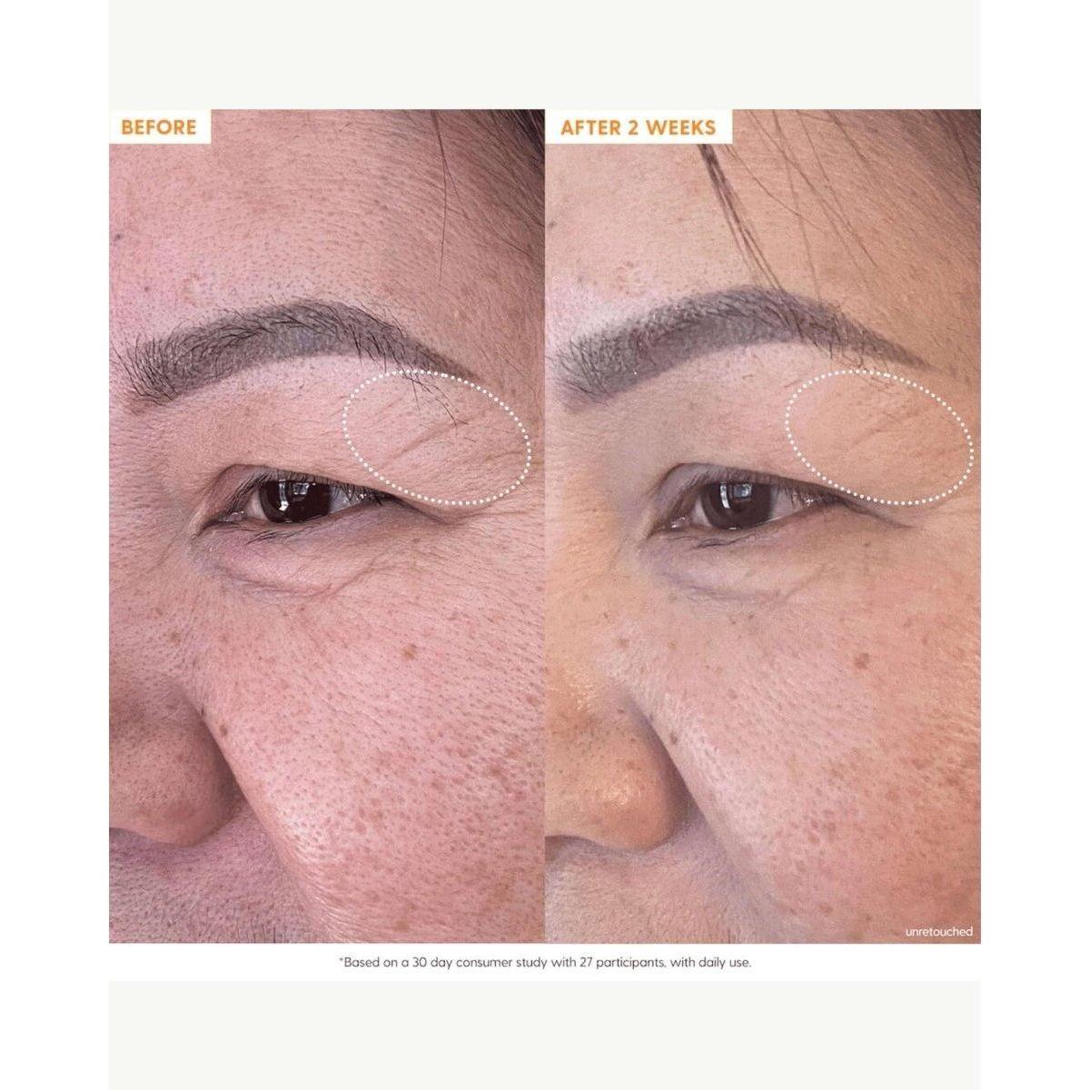 Kinship Brightwave 10% Vitamin C + Peptide Brightening Serum – 30ml | Brighten, Firm & Smooth Kinship Brightwave 10% Vitamin C + Peptide Brightening Serum - 30ml - Glam Global UKKinship