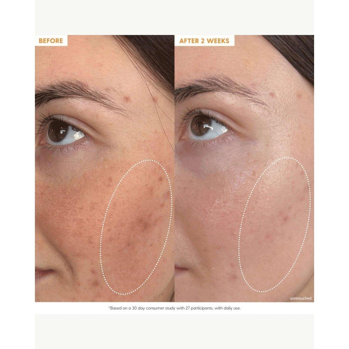 Kinship Brightwave 10% Vitamin C + Peptide Brightening Serum – 30ml | Brighten, Firm & Smooth Kinship Brightwave 10% Vitamin C + Peptide Brightening Serum - 30ml - Glam Global UKKinship