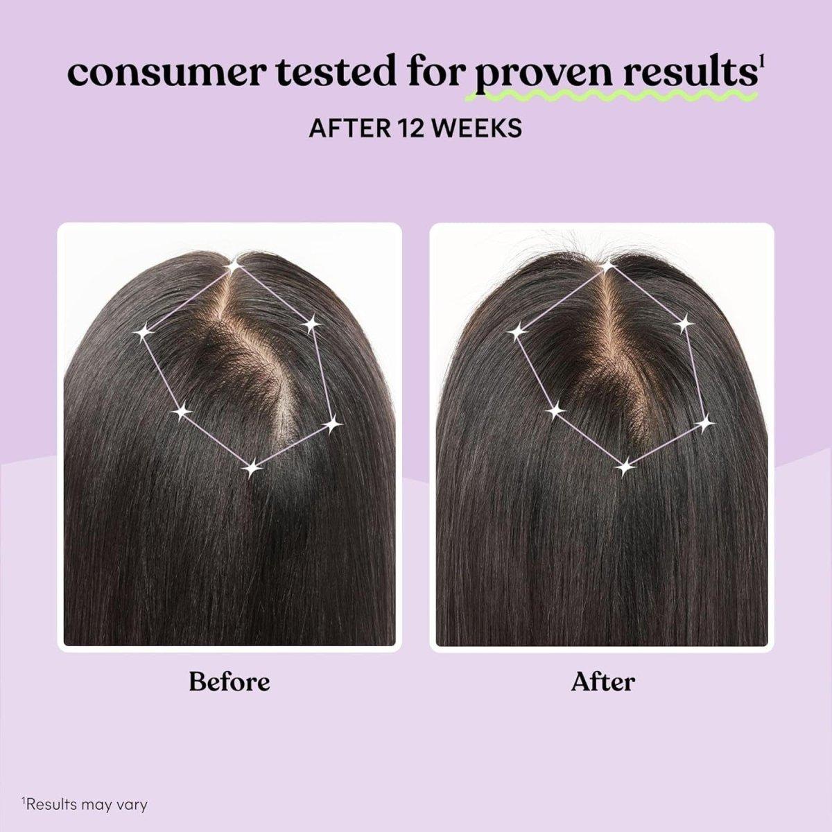 Lemme Grow Hair Growth & Reduced Shedding - 60 Capsules | Thicker, Fuller & Stronger Hair Lemme Grow Hair Growth Reduced Shedding - 1 Month Supply (60 Capsules) - Glam Global UKLemme