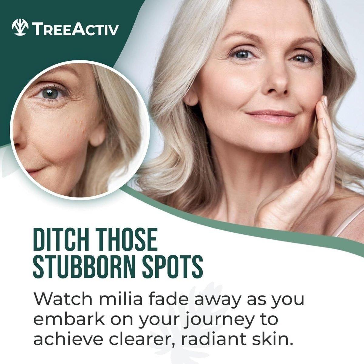 Milia & Acne Spot Treatment – 15ml | Fast-Acting Milia Removal & Skin Smoothing Solution Milia & Acne Spot Treatment 15ml - Fast - Acting Milia Removal Cream - Glam Global UKTreeActiv