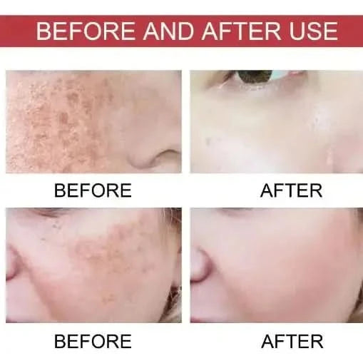 Monika Niacinamide Moisturizing Care Solution – 100ml | Hydrate, Refine & Even Skin Tone Monika Niacinamide Moisturizing Care Solution - 100ml - Glam Global UKGlam Global UK