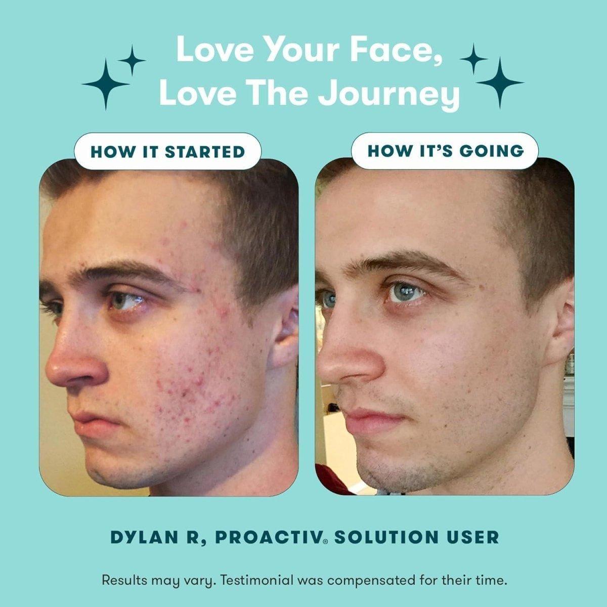 Proactiv 3-Step Acne Treatment Kit | Benzoyl Peroxide Face Wash | 30-Day Complete Acne Skin Care Kit Proactiv 3 Step Acne Treatment - Benzoyl Peroxide Face Wash - 30 Day Complete Acne Skin Care Kit - Glam Global UKProactiv