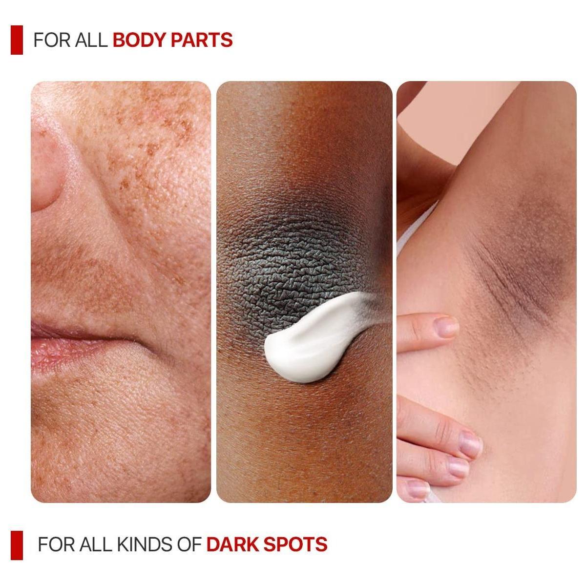 Remedial Pax Dark Spot Corrector – 55ml | Brightening Cream for Dark Spots, Scars & Uneven Tone Remedial Pax Dark Spot Corrector - 55ml - Glam Global UKRemedial Pax