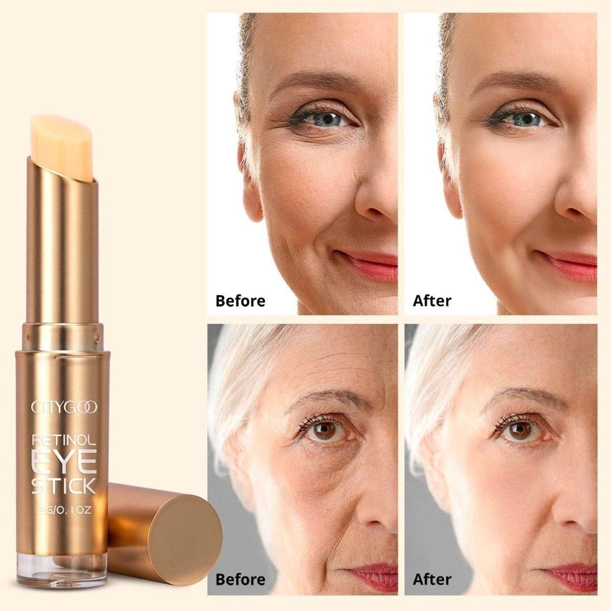 CITYGOO Retinol Eye Stick with Collagen - 30ml | Dark Circles, Puffiness & Fine Lines Treatment CITYGOO Retinol Eye Stick with Collagen - 30ml - Glam Global UKCITYGOO