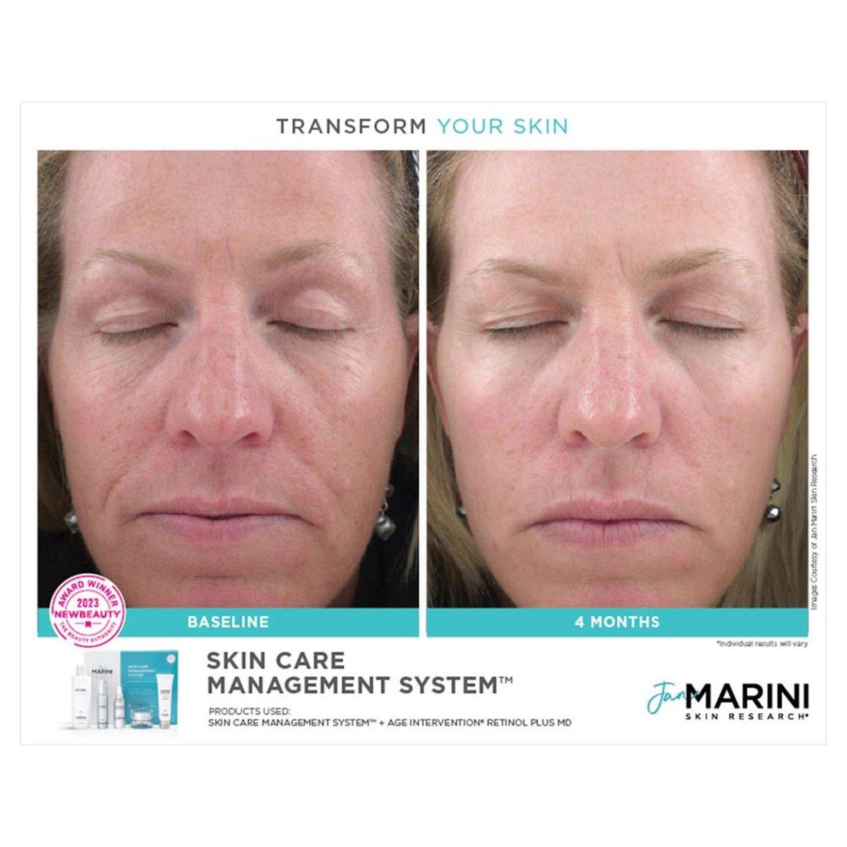 Jan Marini Skin Care Management System – Normal/Combination Skin | Award-Winning 5-Step Routine with SPF 33 Jan Marini Skin Care Management System for Normal/Combination Skin with Antioxidant Daily Face Protectant SPF 33 | Award - Winning Skincare - Glam Global UKJan Marini