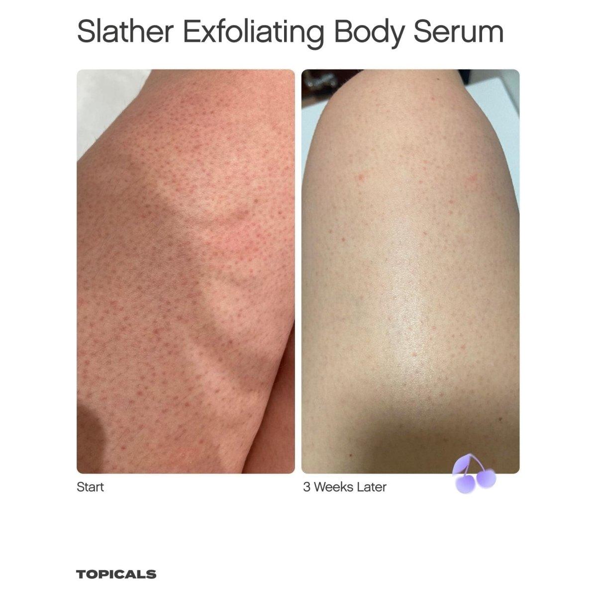 Topicals Soft Touch Body Duo | Hydrating & Exfoliating Set for Smooth, Radiant Skin Topicals Soft Touch Body Duo - Glam Global UKTopicals