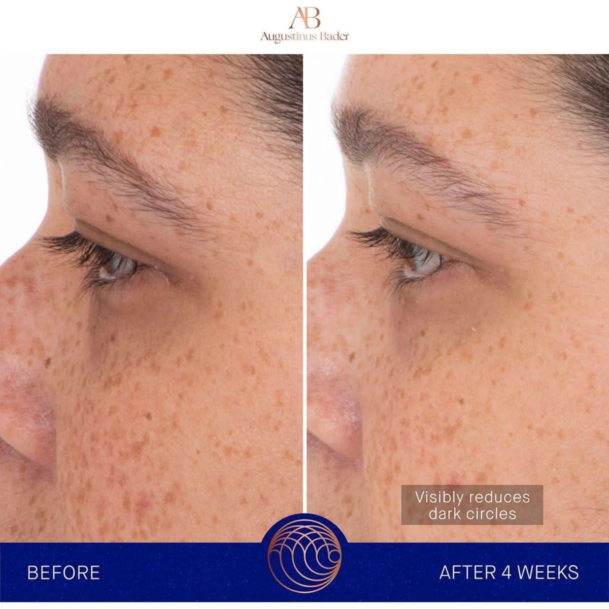 Augustinus Bader The Eye Patches – 6 Pairs | Revitalising Hydrogel Eye Masks Powered by TFC8® Technology Augustinus Bader The Eye Patches | Revitalizing Hydrogel Eye Treatment - Glam Global UKAugustinus Bader