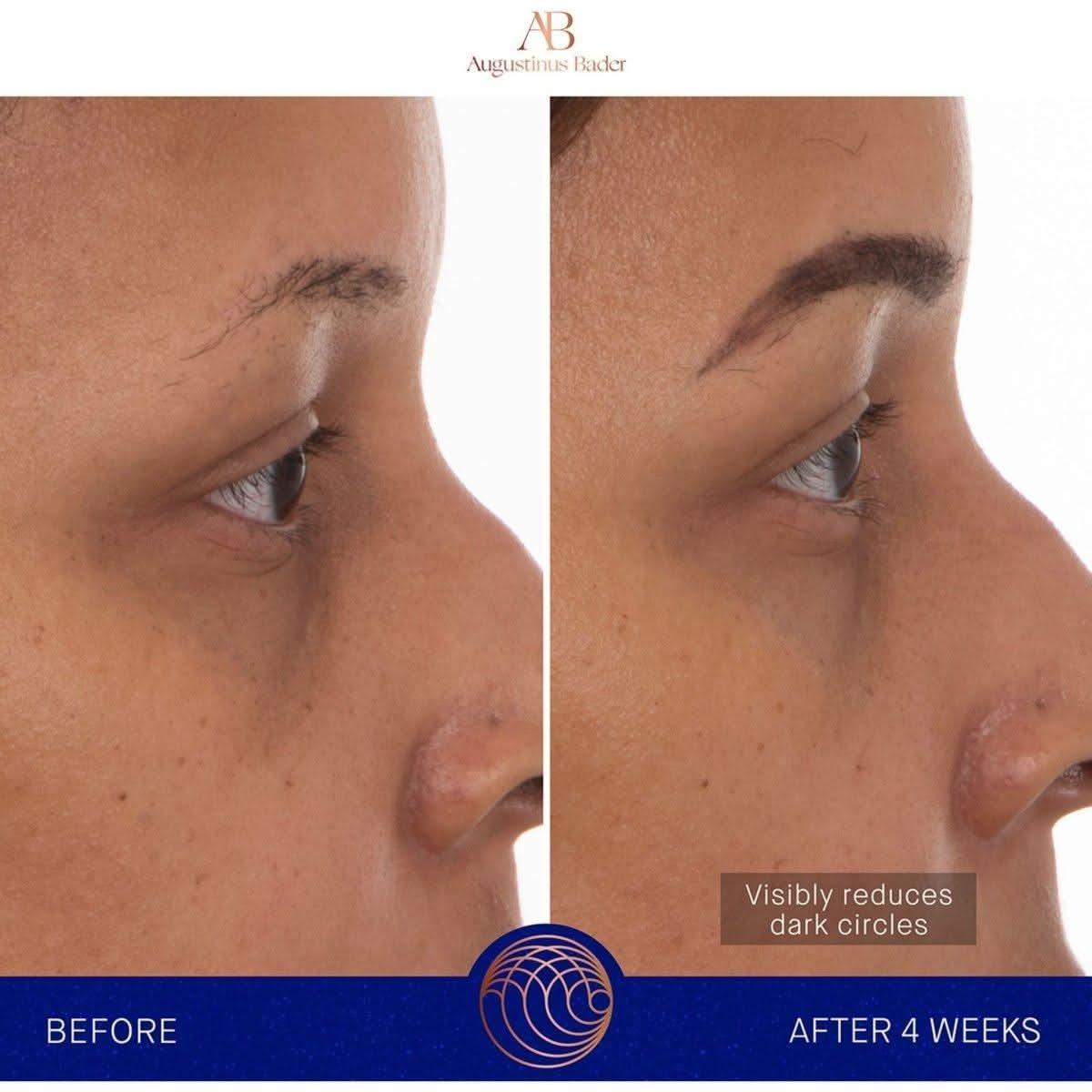 Augustinus Bader The Eye Patches – 6 Pairs | Revitalising Hydrogel Eye Masks Powered by TFC8® Technology Augustinus Bader The Eye Patches | Revitalizing Hydrogel Eye Treatment - Glam Global UKAugustinus Bader