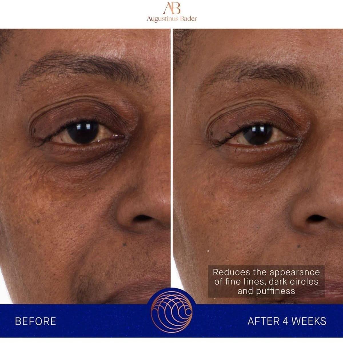 Augustinus Bader The Eye Patches – 6 Pairs | Revitalising Hydrogel Eye Masks Powered by TFC8® Technology Augustinus Bader The Eye Patches | Revitalizing Hydrogel Eye Treatment - Glam Global UKAugustinus Bader