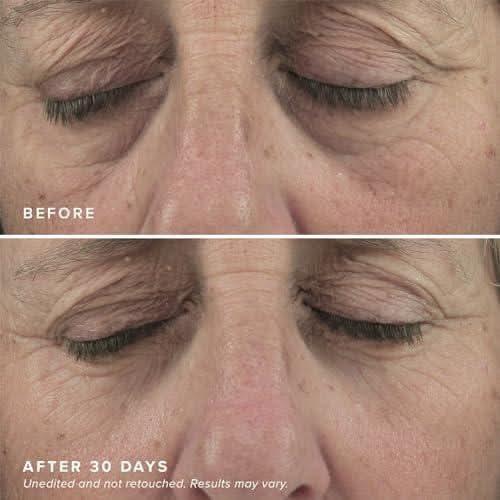 DRMTLGY Mascarillas iluminadoras para ojos - Mascarillas para ojos con cafeína - 60 parches debajo de los ojos  DRMTLGY Brightening Eye Masks - Caffeine Eye Masks - 60 Under Eye Patches - Glam Global UKDRMTLGY