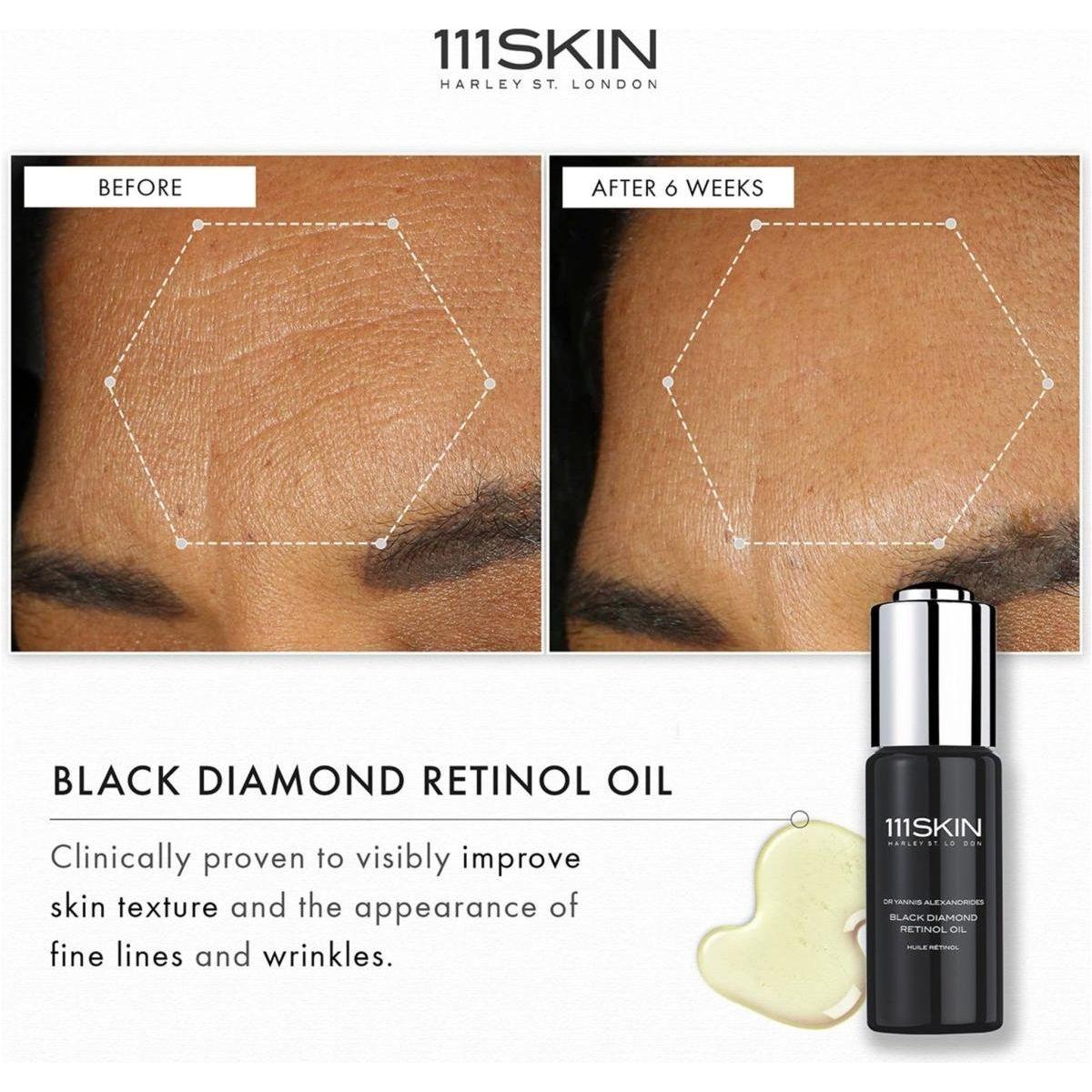 111SKIN Black Diamond Retinol Oil – 30ml | Advanced Anti-Aging & Skin Renewal Treatment 111SKIN Black Diamond Retinol Oil - 30ml - Glam Global UK111SKIN