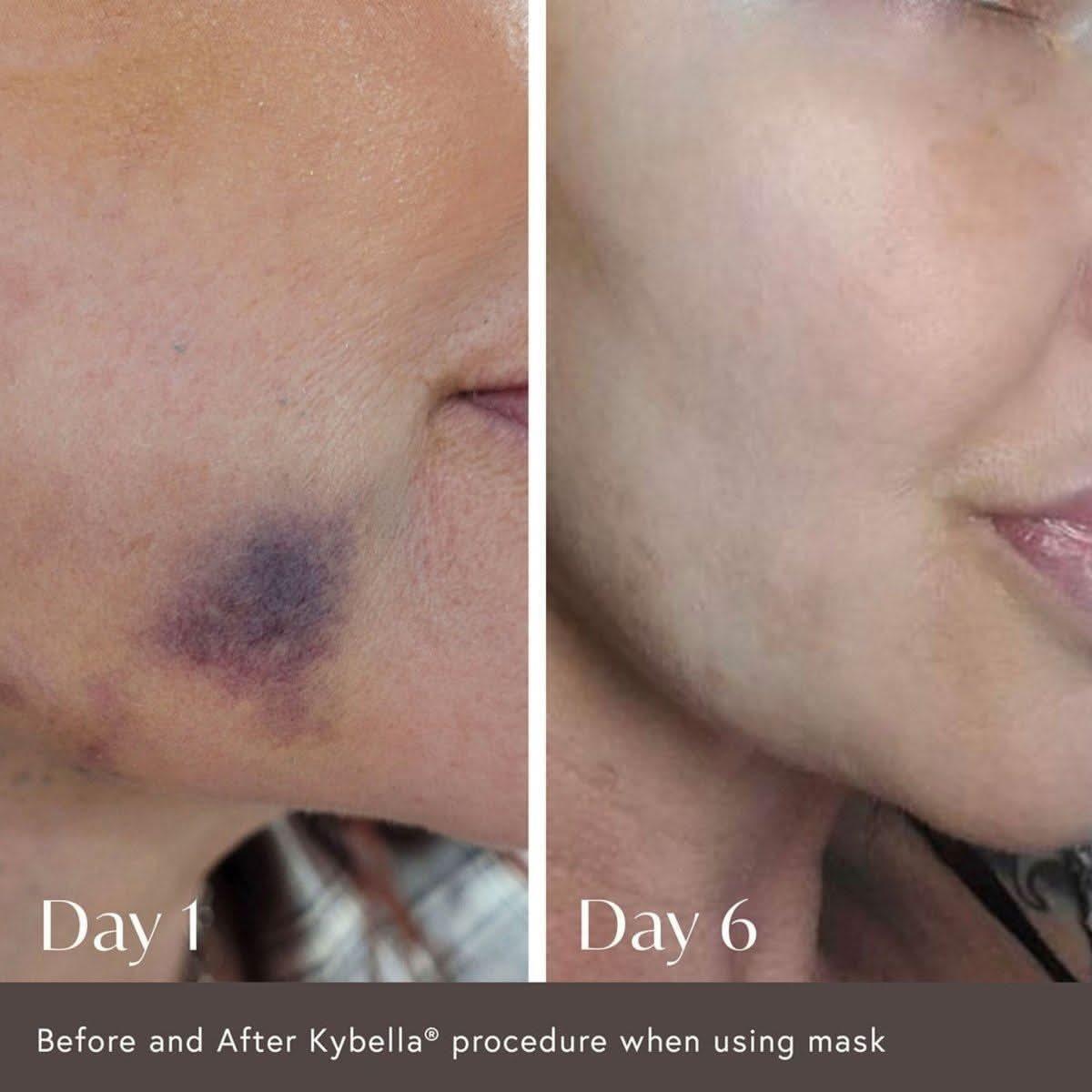 Viktor Michael Ciao For Now Post Injection Care Mask – 50ml | Rapid Recovery & Radiance Support Viktor Michael Ciao For Now Post Injection Care Mask - 50ml - Glam Global UKViktor Michael