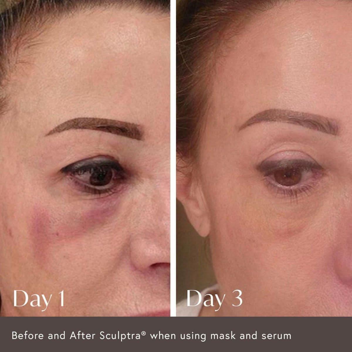 Viktor Michael Ciao For Now Post Injection Care Mask – 50ml | Rapid Recovery & Radiance Support Viktor Michael Ciao For Now Post Injection Care Mask - 50ml - Glam Global UKViktor Michael