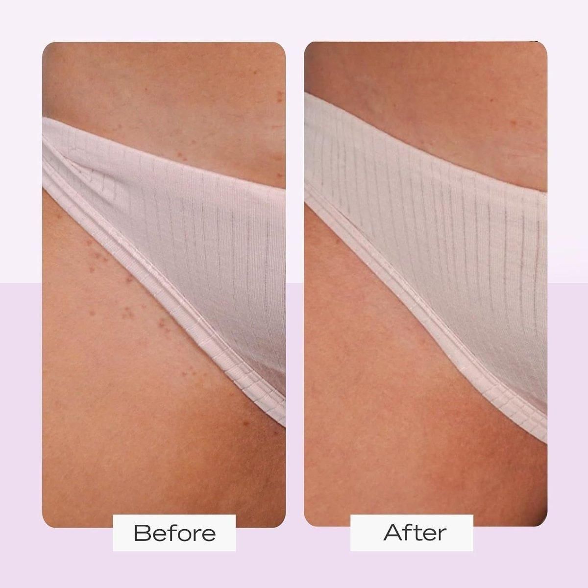 First Aid Beauty Ingrown Hair Pads with BHA & AHA – 28 Pads | Exfoliating & Soothing Treatment First Aid Beauty Ingrown Hair Pads with BHA & AHA – 28 Pads - Glam Global UKFirst Aid Beauty