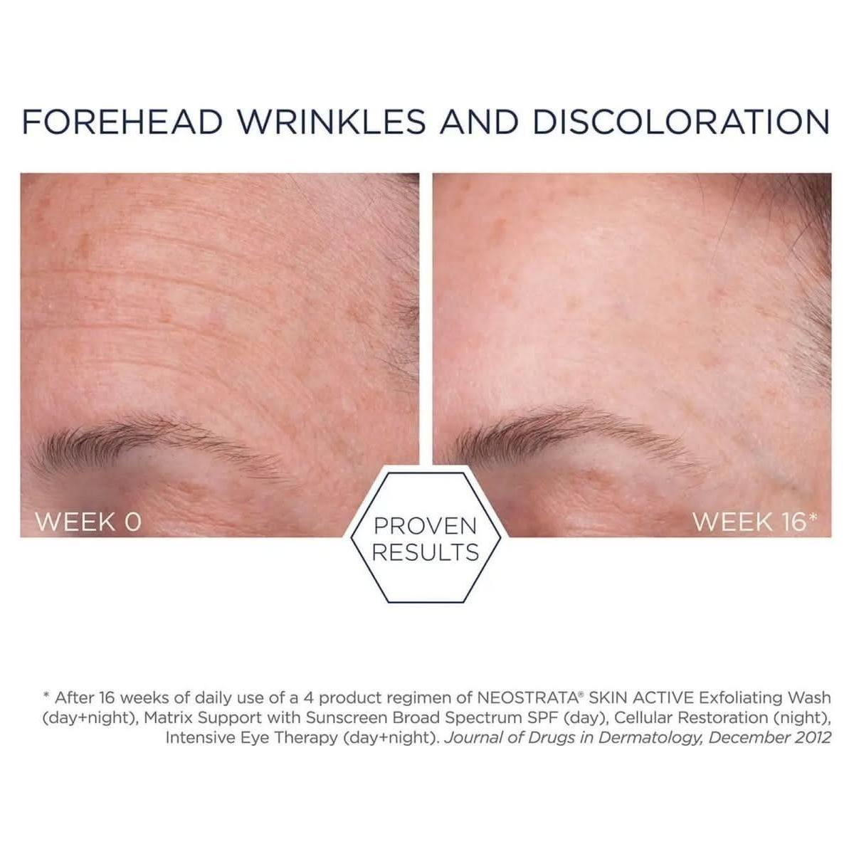 Neostrata Cellular Restoration – 50ml | Anti-Ageing Treatment with 15% AHA/PHA Blend for Skin Renewal Neostrata Cellular Restoration - 50ml - Glam Global UKNeostrata